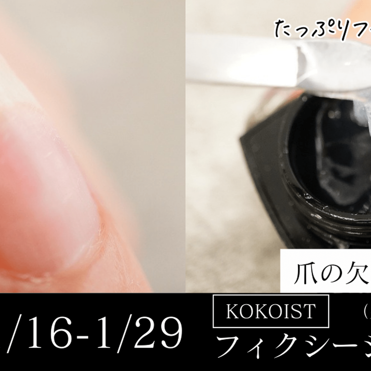 亀裂・欠けに頼れる♡KOKOIST「フィクシージェル」が20％オフ！