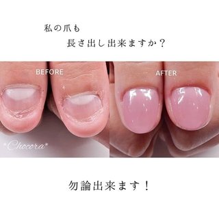 深爪矯正大分市のネイルデザイン ネイルブック