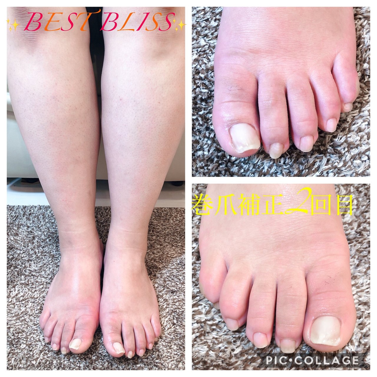 オールシーズン フット お客様 Nail Salon Best Blissのネイルデザイン No ネイルブック