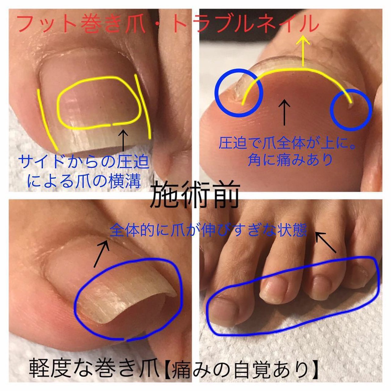 オールシーズン オフィス フット スカルプチュア お客様 Reposenail ルポゼのネイルデザイン No ネイルブック