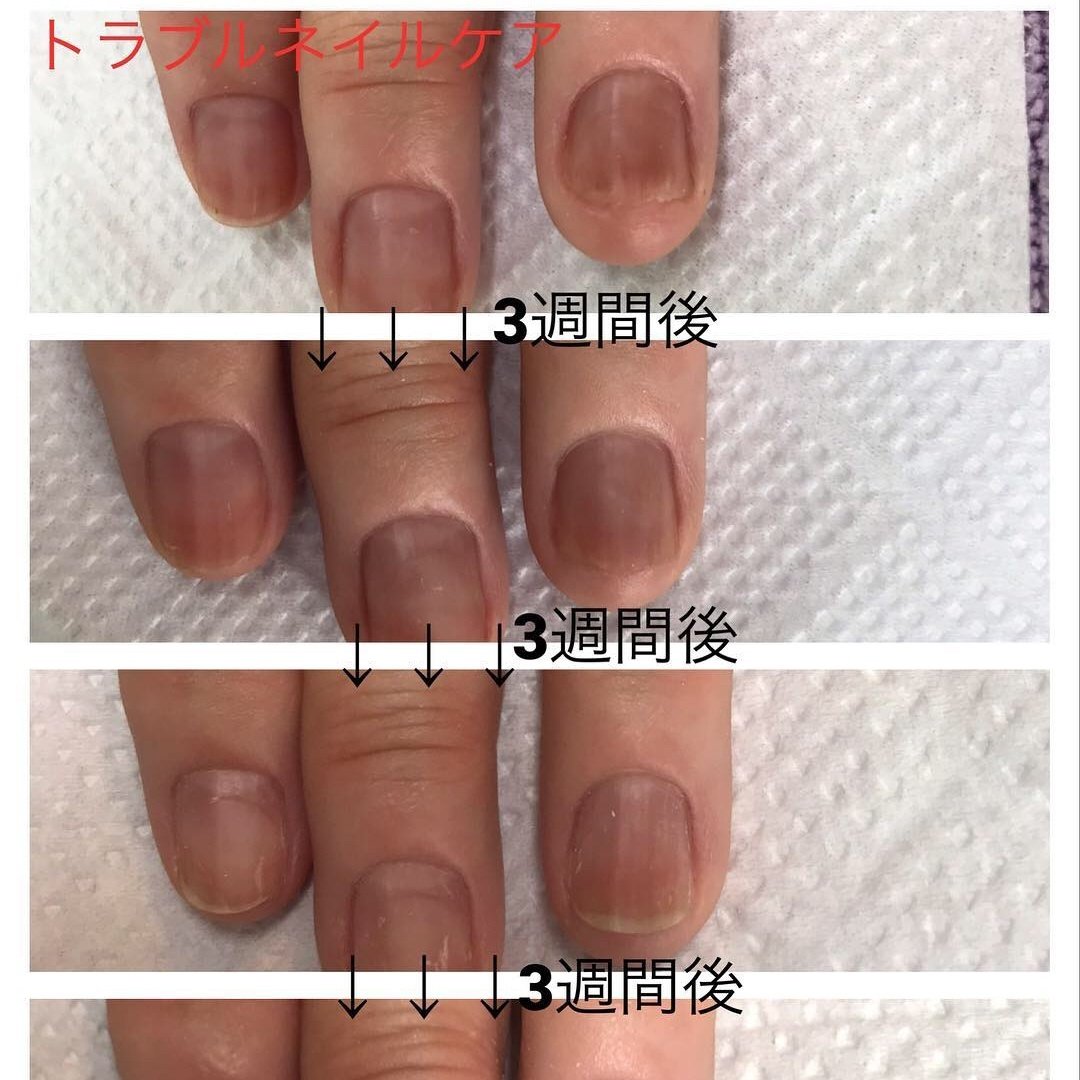 オールシーズン 卒業式 オフィス ブライダル ハンド Reposenail ルポゼのネイルデザイン No ネイルブック