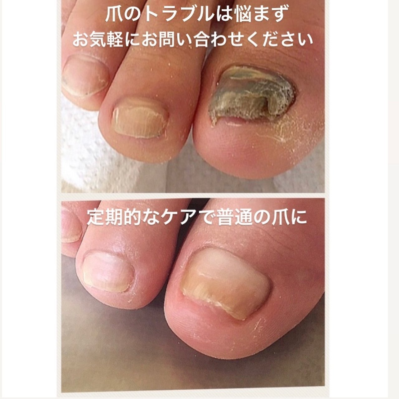 夏 冬 オールシーズン スポーツ フット Irodoriのネイルデザイン No ネイルブック