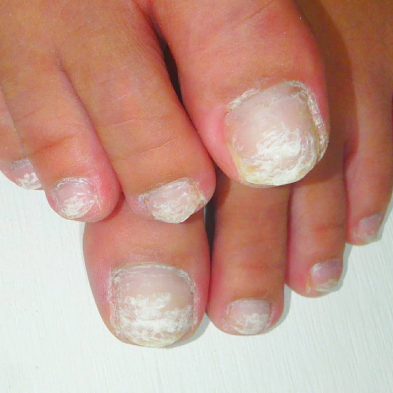 フット さいとうりなのネイルデザイン No ネイルブック