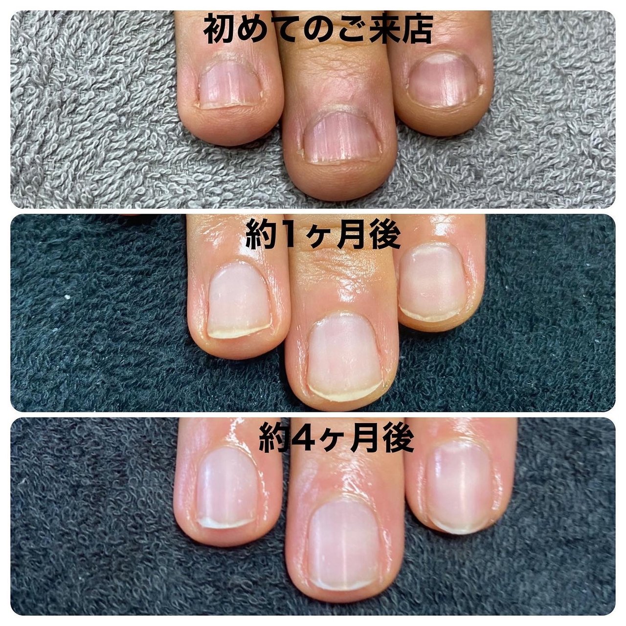 ハンド ジェル お客様 A Nailのネイルデザイン No ネイルブック