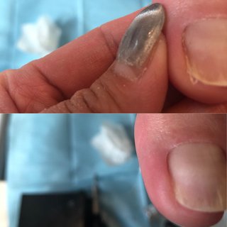 爪周りの固くなった角質ケアのネイルデザイン ネイルブック