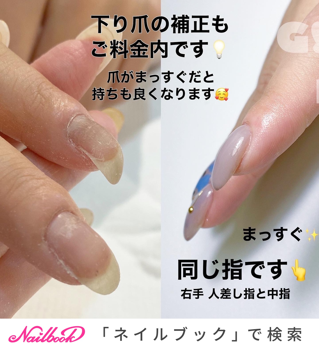 落ち爪のネイルデザイン ネイルブック