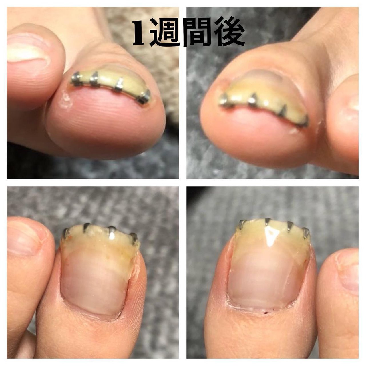 フット ジェルネイル お客様 Nail Spot Yu Aのネイルデザイン No ネイルブック