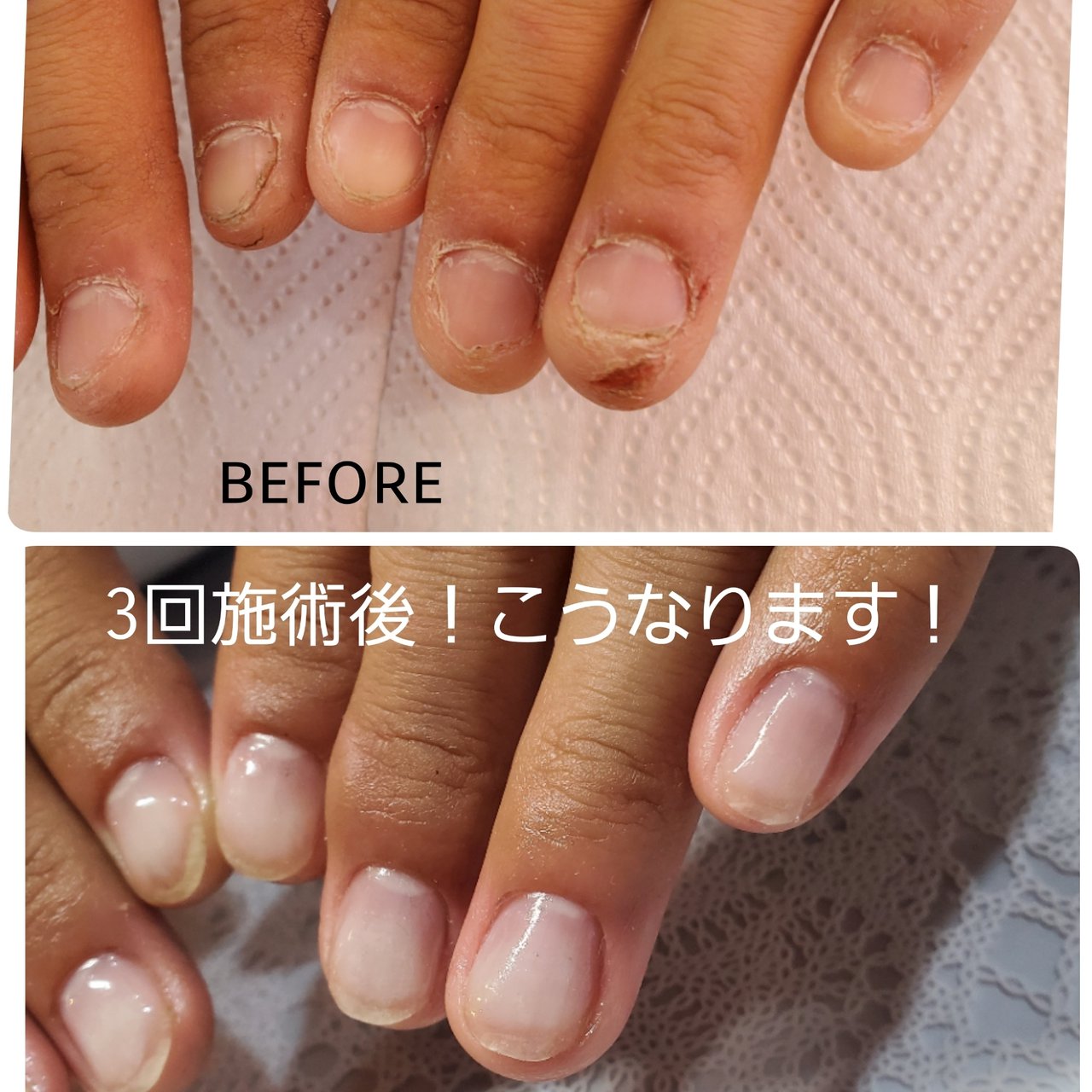 クリア Beaurybar Riekoのネイルデザイン No ネイルブック