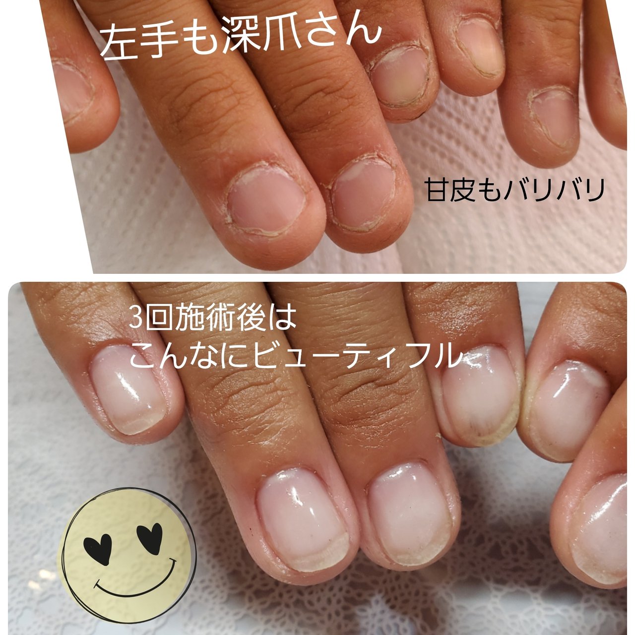 クリア Beaurybar Riekoのネイルデザイン No ネイルブック