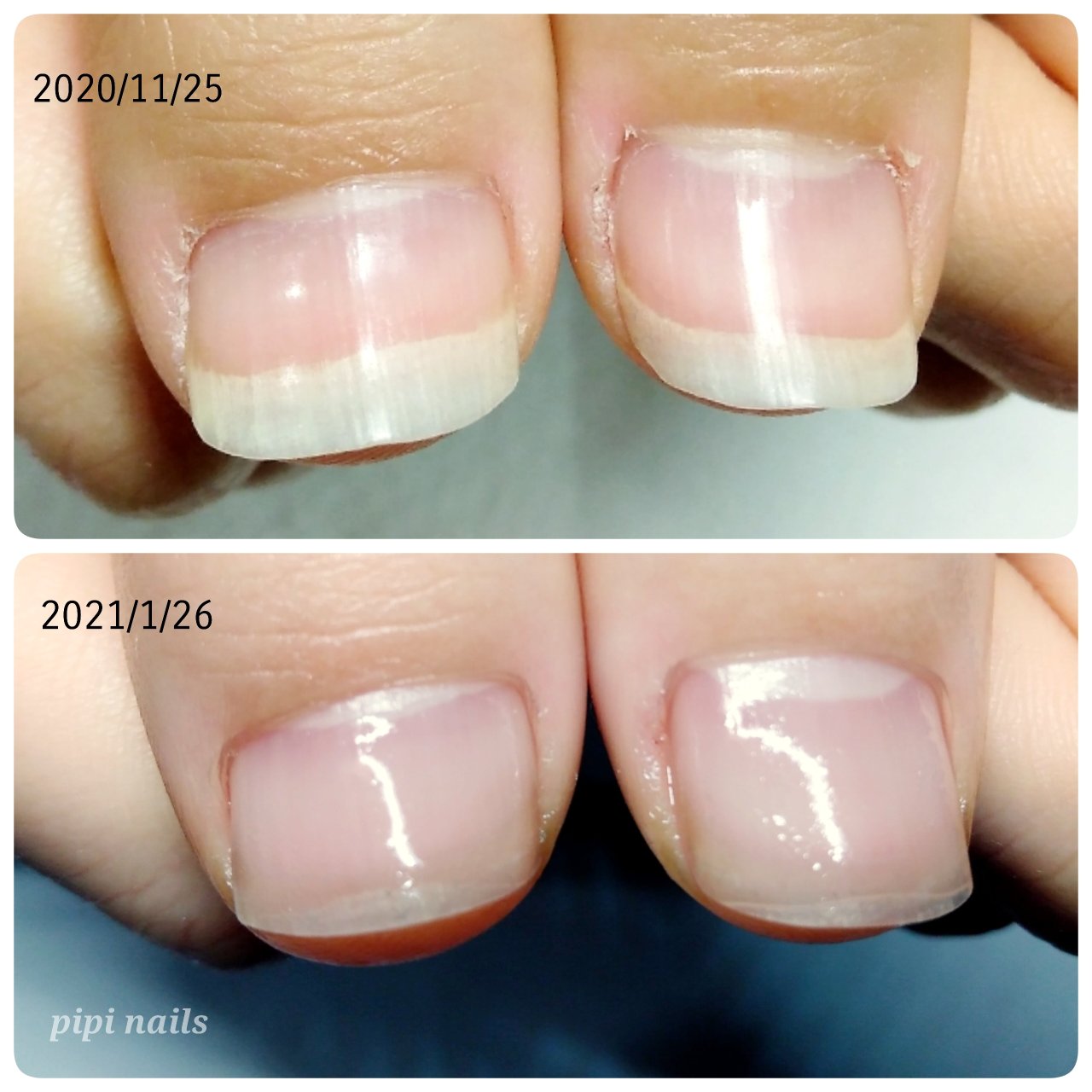 オールシーズン 卒業式 入学式 オフィス ハンド 大阪 八尾ネイルサロン Pipinails フィルイン 深爪 巻爪 地爪育成 自爪育成 トモコのネイルデザイン No ネイルブック