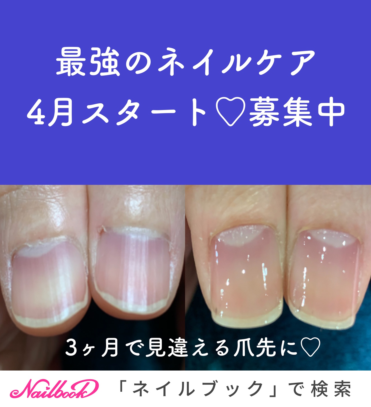 オールシーズン お正月 成人式 ハンド シンプル 小島あゆみ Agemnailstudio のネイルデザイン No ネイルブック