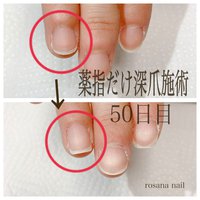 爪コンプレックスのネイルデザイン ネイルブック