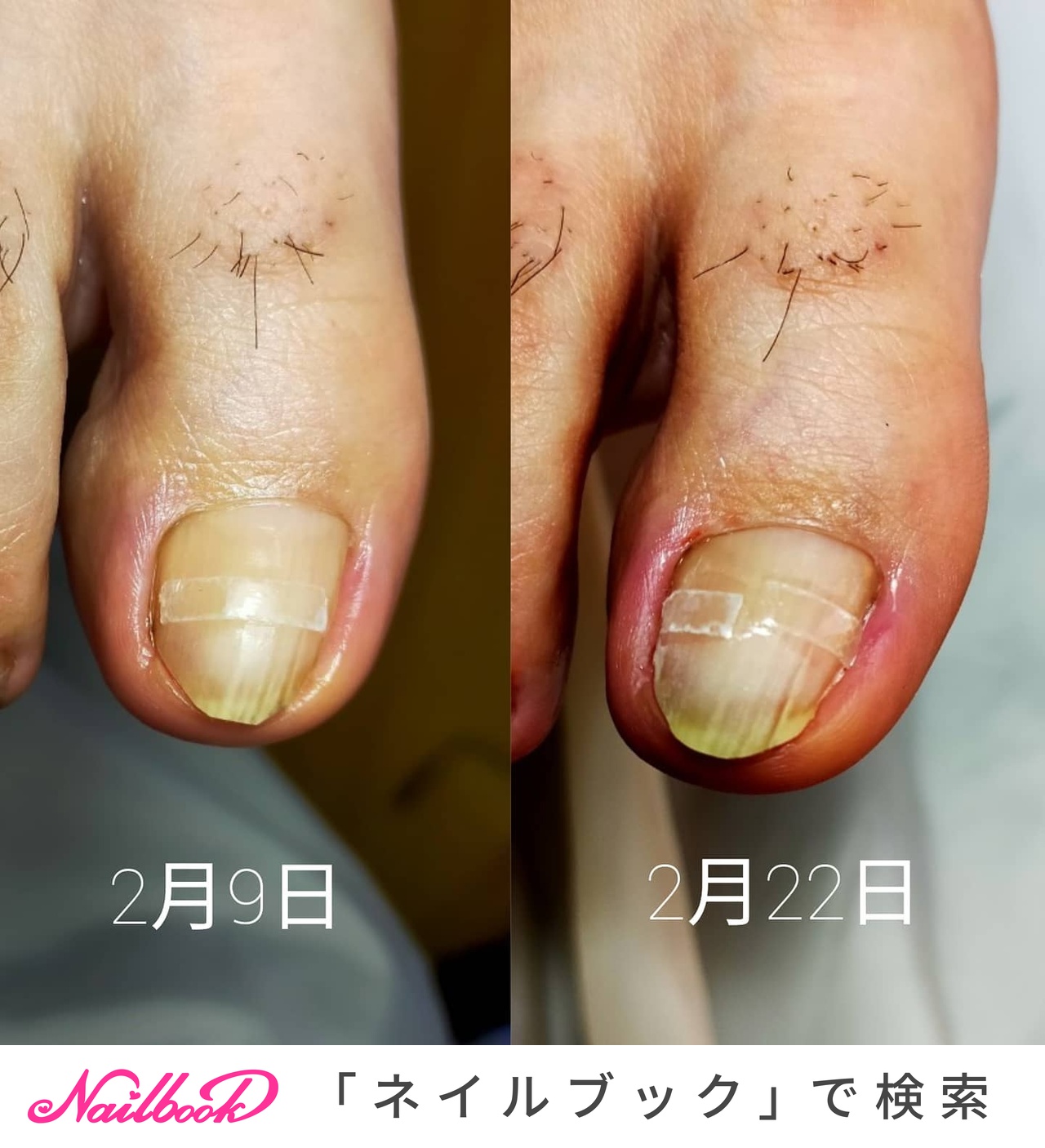 Miraのネイルデザイン No ネイルブック