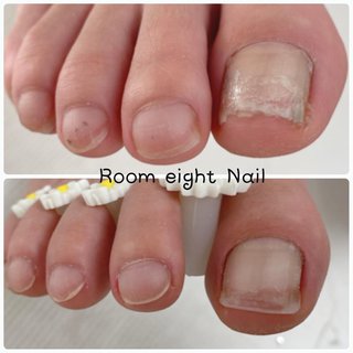 人気順 オールシーズン クリア 爪ボロボロのネイルデザイン ネイルブック