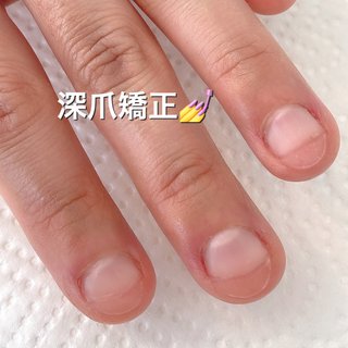 深爪矯正群馬のネイルデザイン ネイルブック