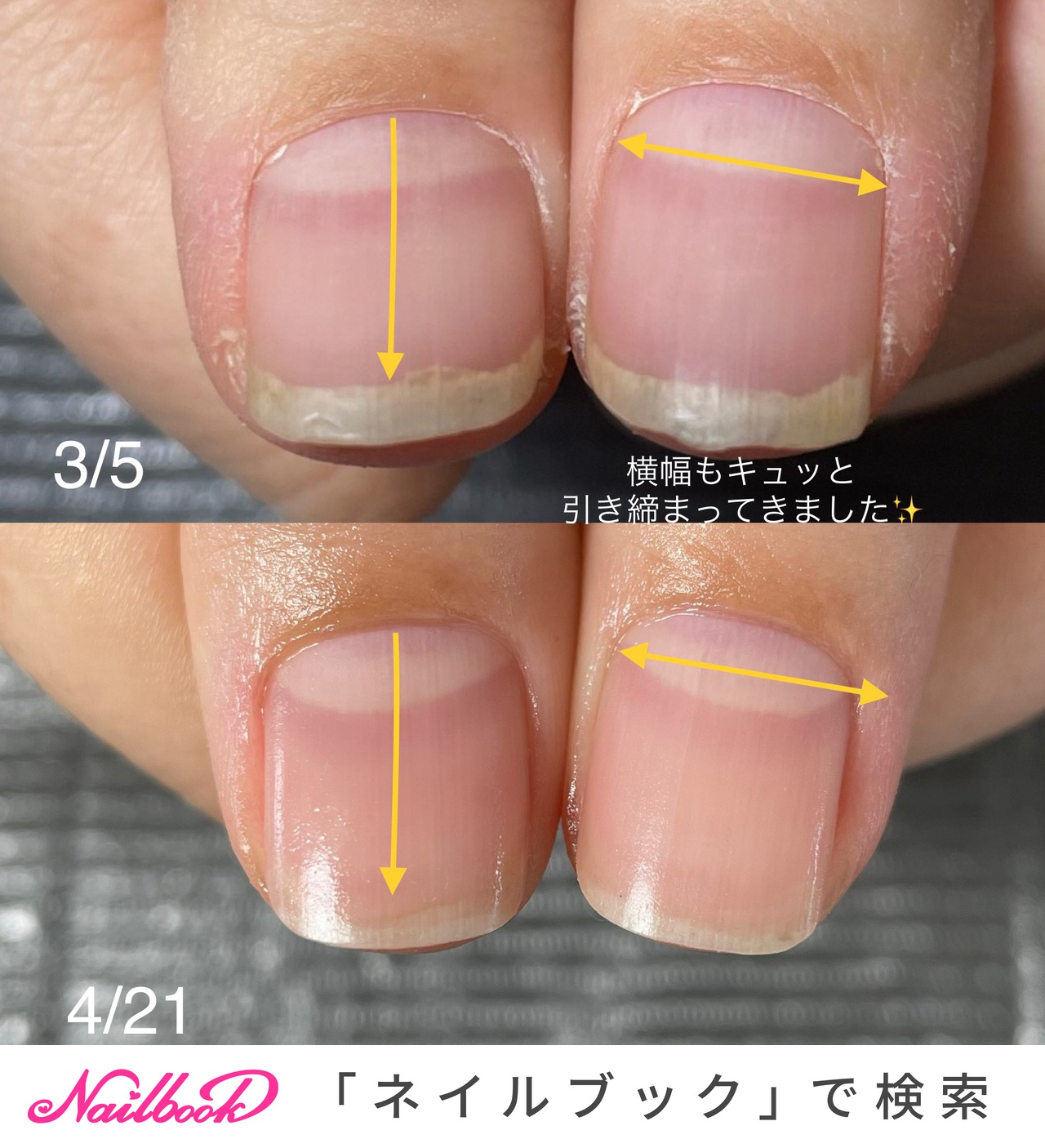 介護士さんネイルのネイルデザイン ネイルブック