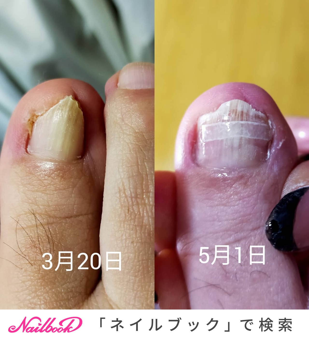 Miraのネイルデザイン No ネイルブック
