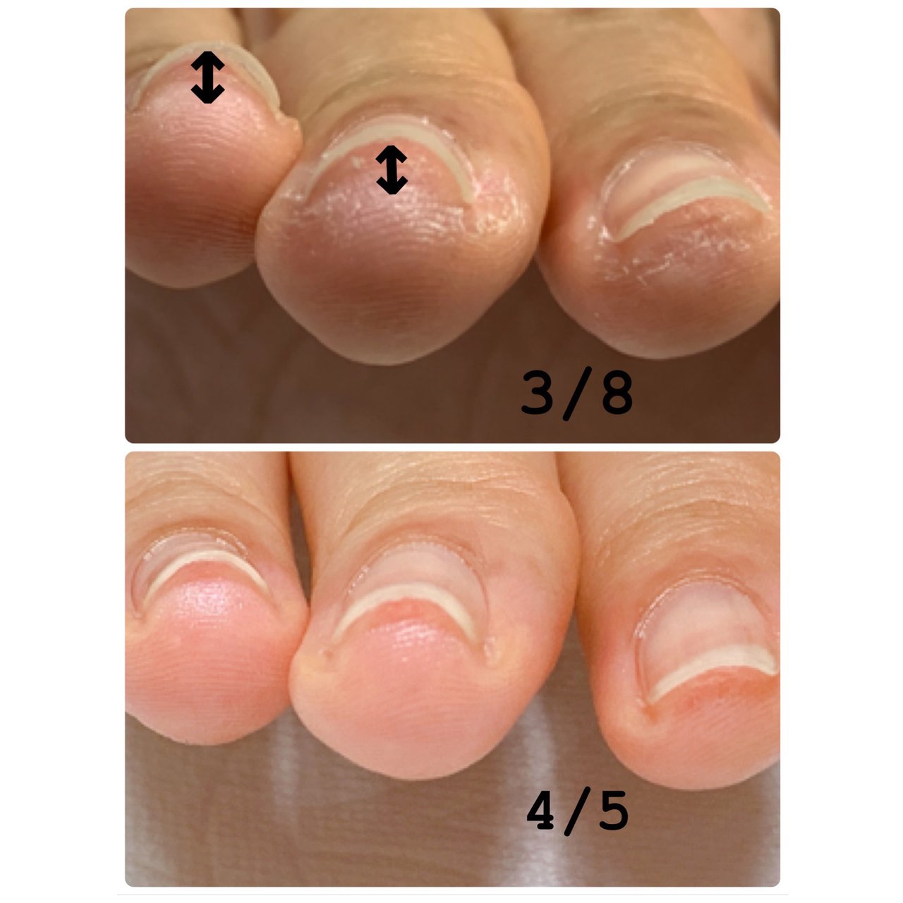 Nukuのネイルデザイン No ネイルブック