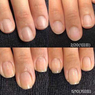 ネイルケア熊本のネイルデザイン ネイルブック
