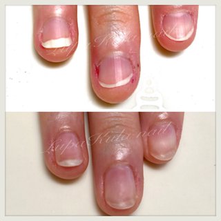 人気順 ショート 爪噛み癖のネイルデザイン ネイルブック