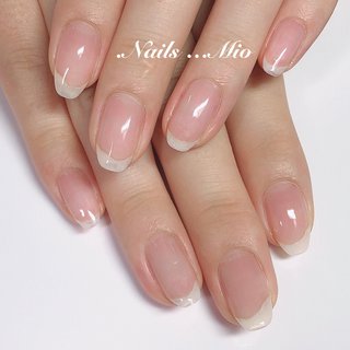 赤羽巻爪矯正ケアのネイルデザイン ネイルブック