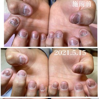 毟り爪のネイルデザイン ネイルブック