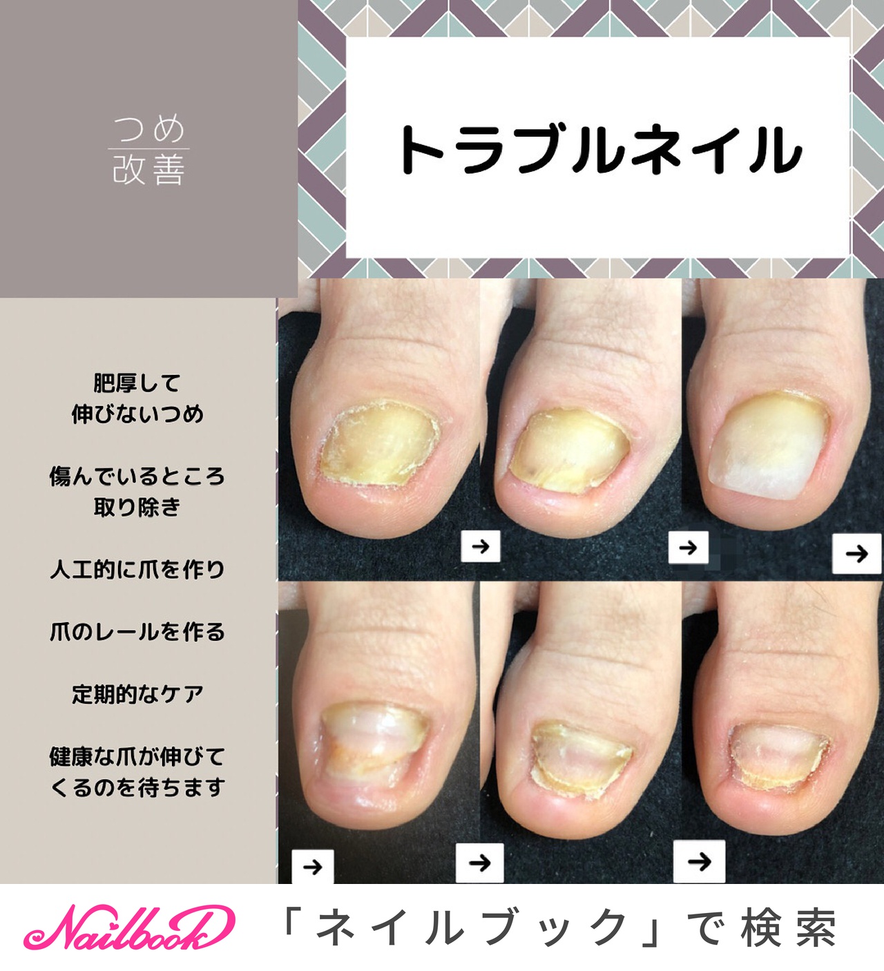 オールシーズン フット シンプル ショート お客様 東大和ネイルスタジオサンのネイルデザイン No ネイルブック