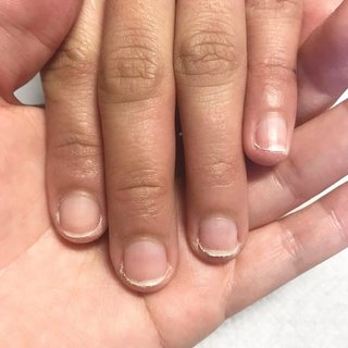 爪コンプレックスのネイルデザイン ネイルブック