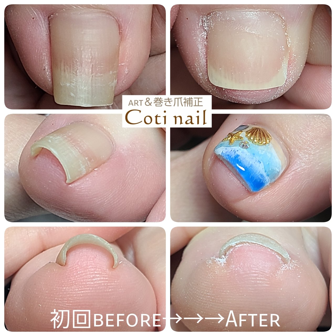 夏 海 リゾート 浴衣 フット コチネイル えりのネイルデザイン No ネイルブック