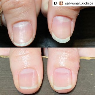 吉祥寺 爪に優しいネイルサロン 美爪屋mincono 吉祥寺のネイルサロン ネイルブック