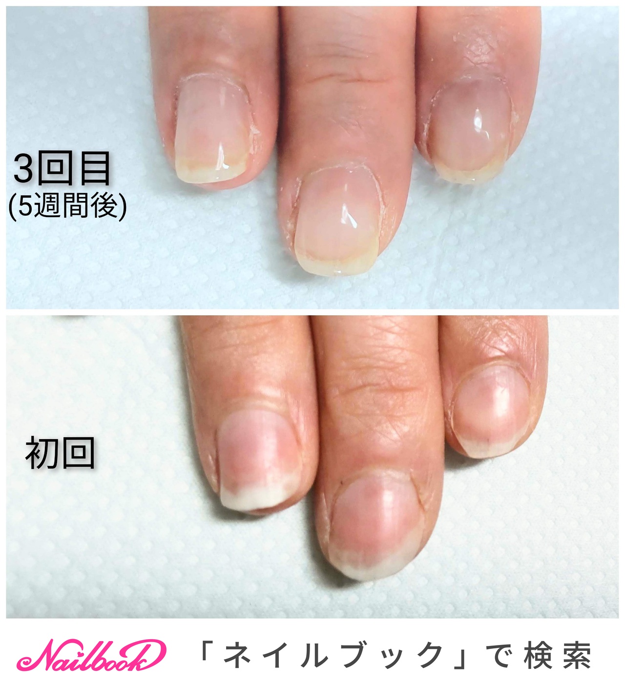 オールシーズン ハンド ショート クリア ジェル Tinkumiのネイルデザイン No ネイルブック