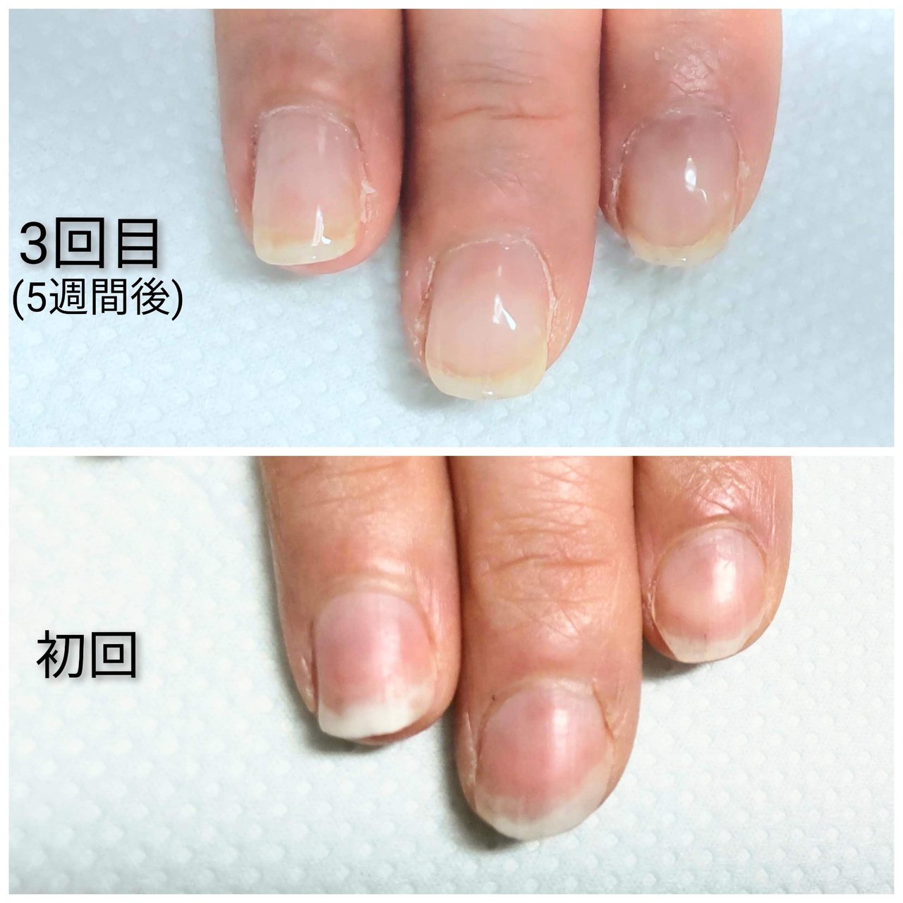 オールシーズン ハンド ショート クリア ジェル Tinkumiのネイルデザイン No ネイルブック