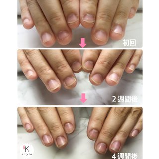 爪薄いのネイルデザイン ネイルブック