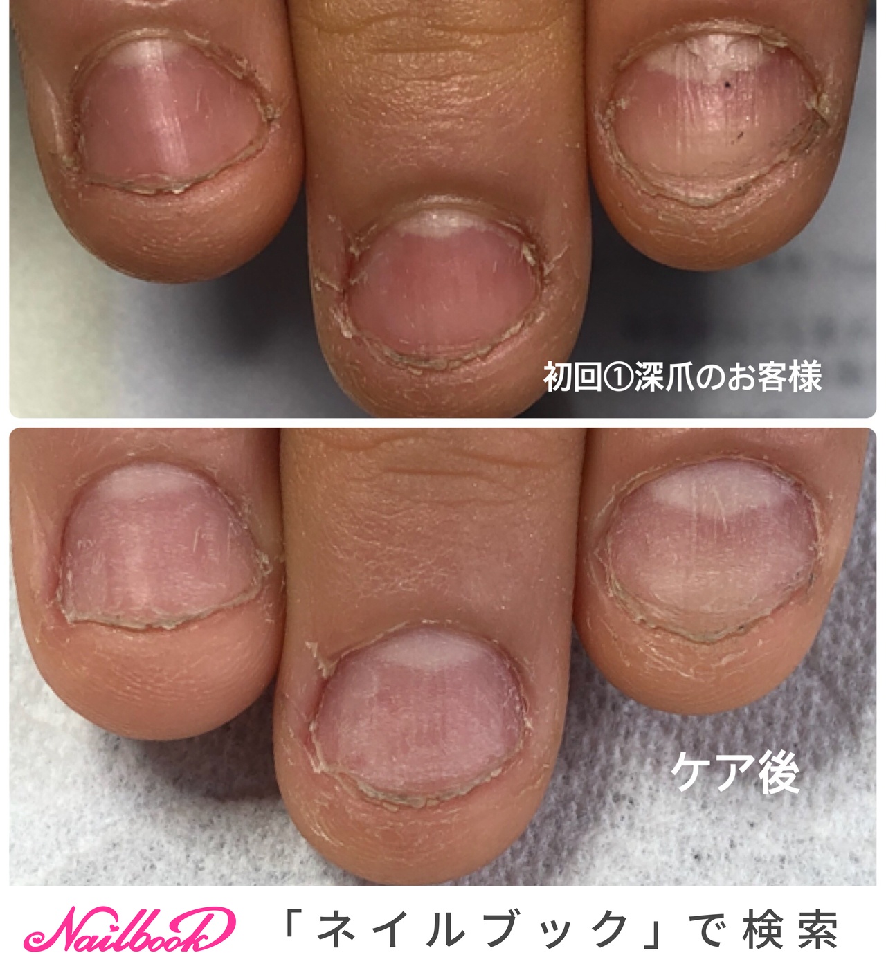 深爪2ヶ月後の写真のネイルデザイン ネイルブック