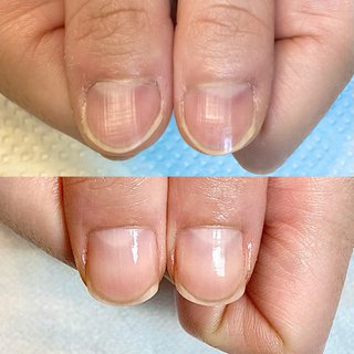 自爪育成六甲道のネイルデザイン ネイルブック