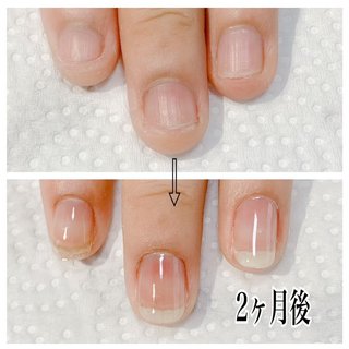 爪噛みのネイルデザイン ネイルブック