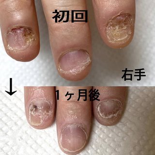 メンズネイル仙台のネイルデザイン ネイルブック