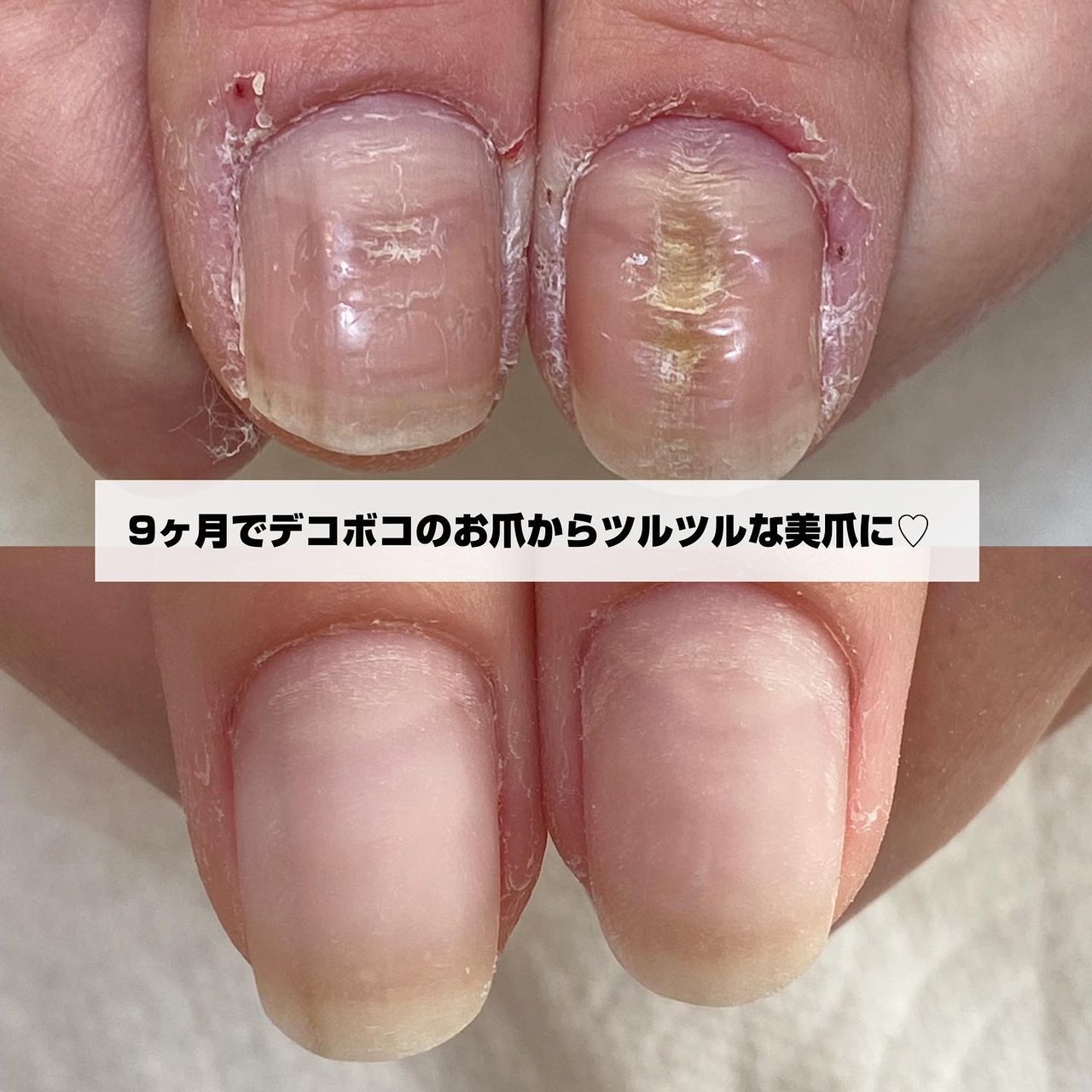 オールシーズン オフィス ブライダル ハンド 仙台 自爪育成サロン Nailsalon W のネイルデザイン No ネイルブック