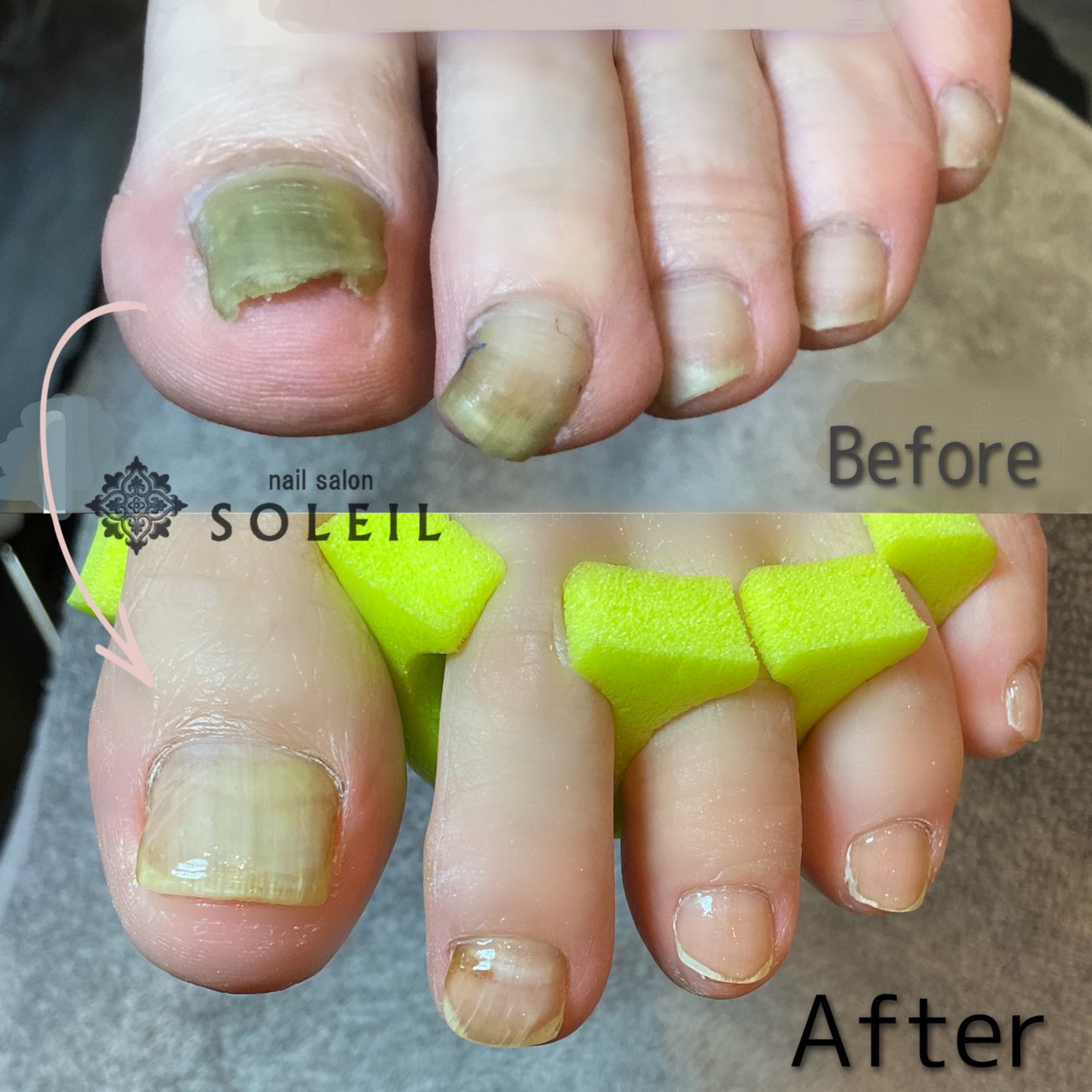 フット お客様 Nail Salon Soleil ネイルサロン ソレイユ のネイルデザイン No ネイルブック