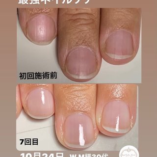 おすすめ順 しじみ爪のネイルデザイン ネイルブック