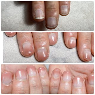 佐倉スターネイル Starnail 京成臼井のネイルサロン ネイルブック