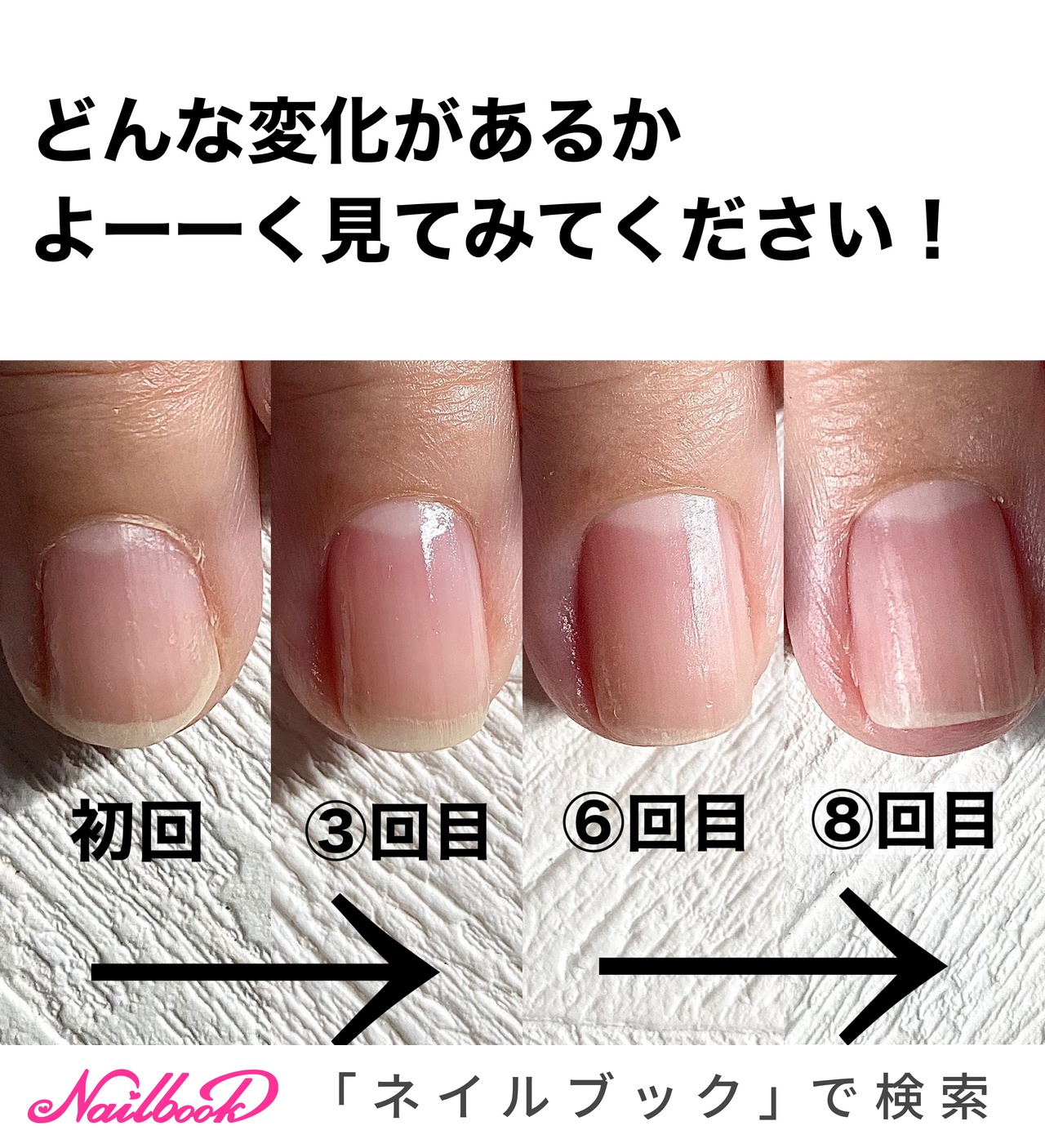 neocolle_p-zx3291