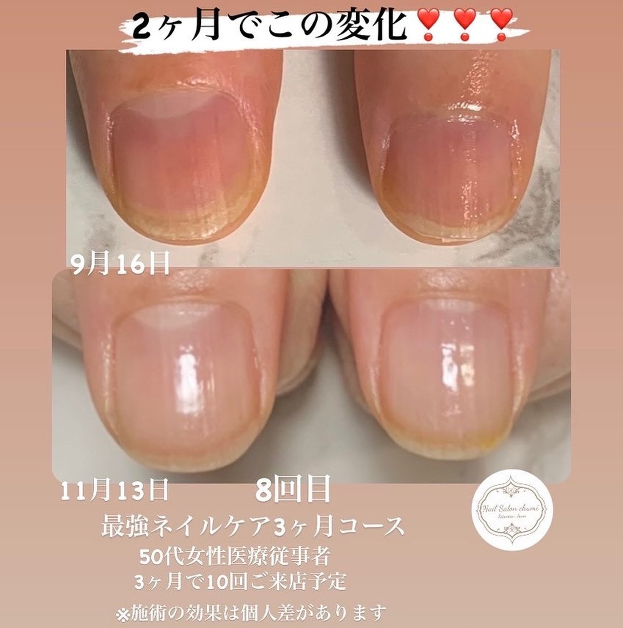 お客様 Chumiのネイルデザイン No ネイルブック