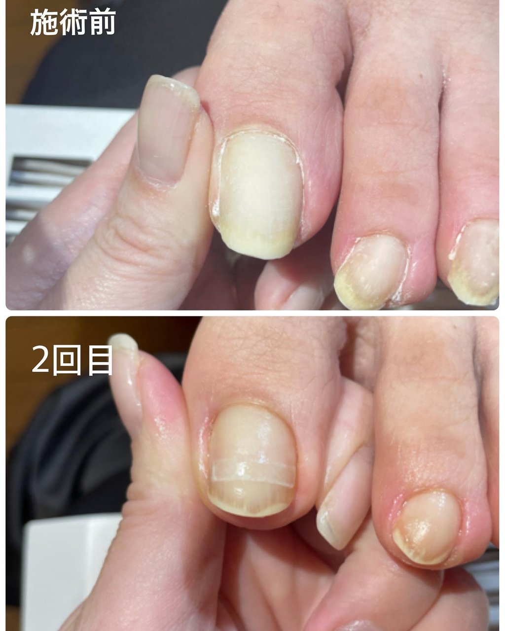お客様 Prunelleのネイルデザイン No ネイルブック