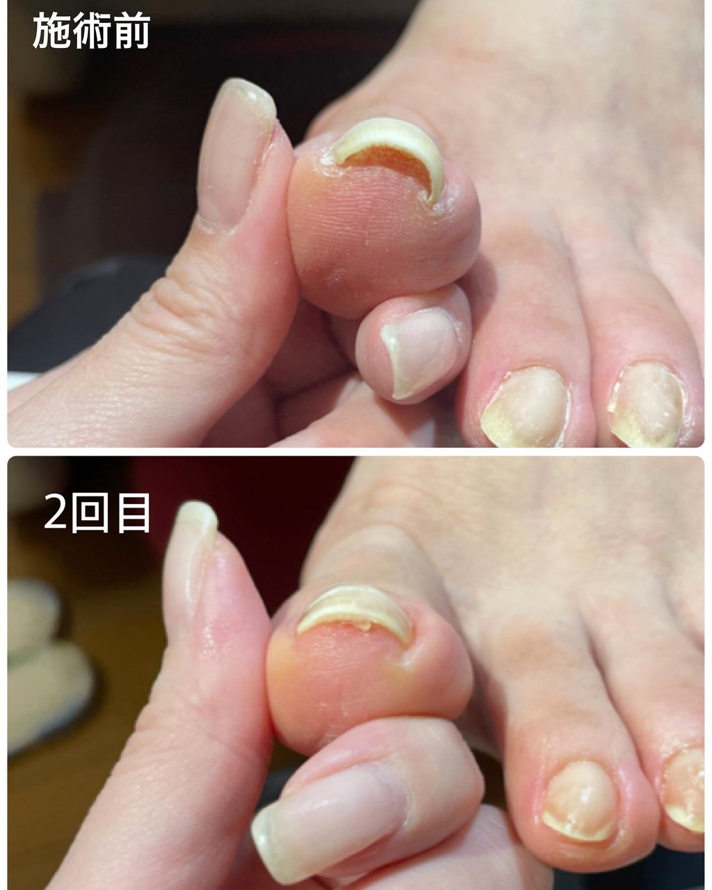 お客様 Prunelleのネイルデザイン No ネイルブック