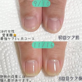 薄い爪のネイルデザイン ネイルブック