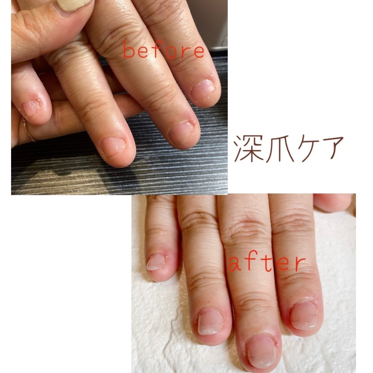卒業式 入学式 ブライダル パーティー お客様 Nailroom Koa はざまみなみのネイルデザイン No ネイルブック
