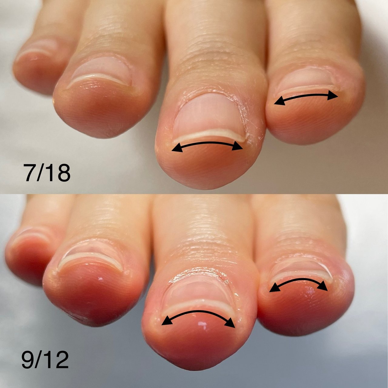 ネイルサロンティンブレのネイルデザイン No ネイルブック