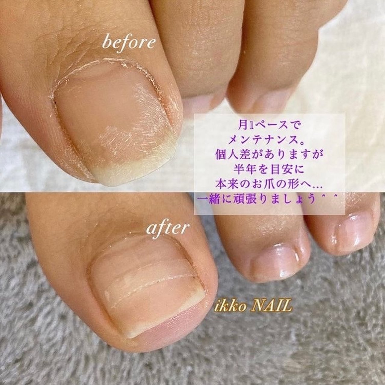 Ikkonailのネイルデザイン No ネイルブック