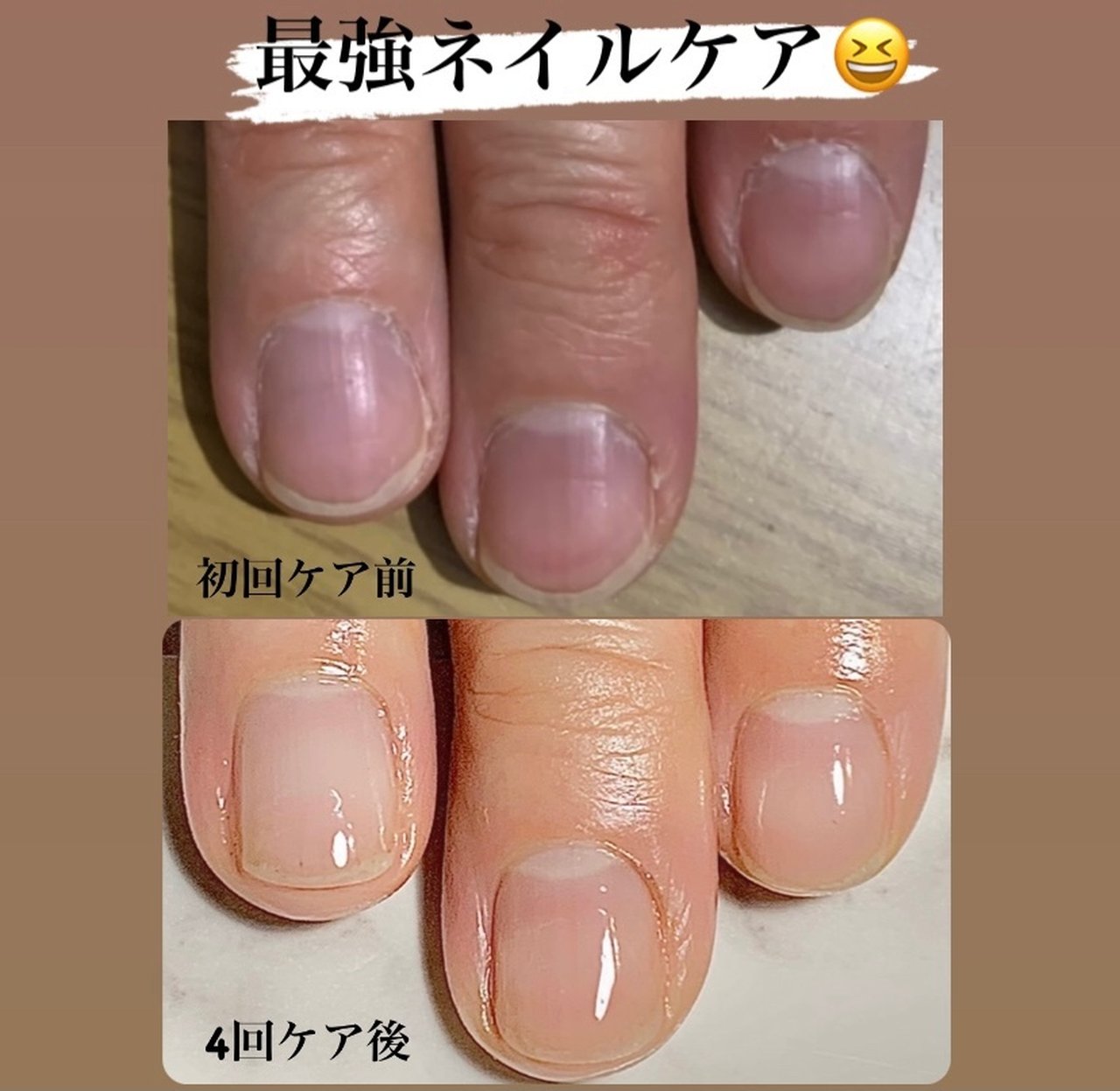 お客様 Chumiのネイルデザイン No ネイルブック